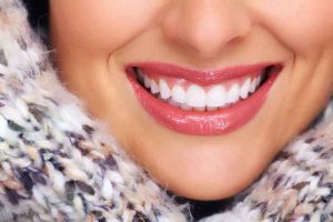 Perfect Smile with White Teeth